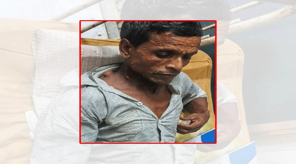 মস্তফা-লিলা ফাউন্ডেশনের সহযোগিতায় দিনমজুর নাজিম উদ্দিনের সফল অপারেশন